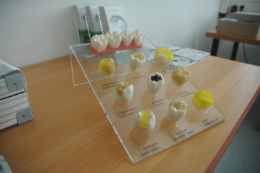 Kronen- und Brückendisplay